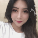 眼综合（双眼皮、开眼角、下至）案例分享